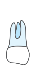 Tooth 18