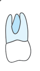 Tooth 26
