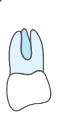 Tooth 27