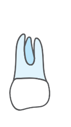 Tooth 28