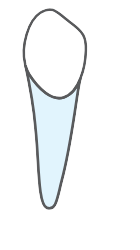Tooth 33
