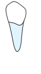 Tooth 35